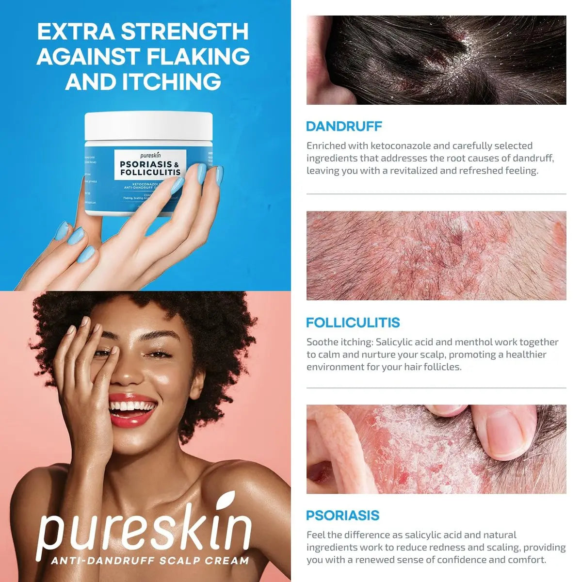 PURESKIN Scalp Cream for Psoriasis & Folliculitis – Herbal Relief for Itching & Flaking, 3.4 Oz Avelisse