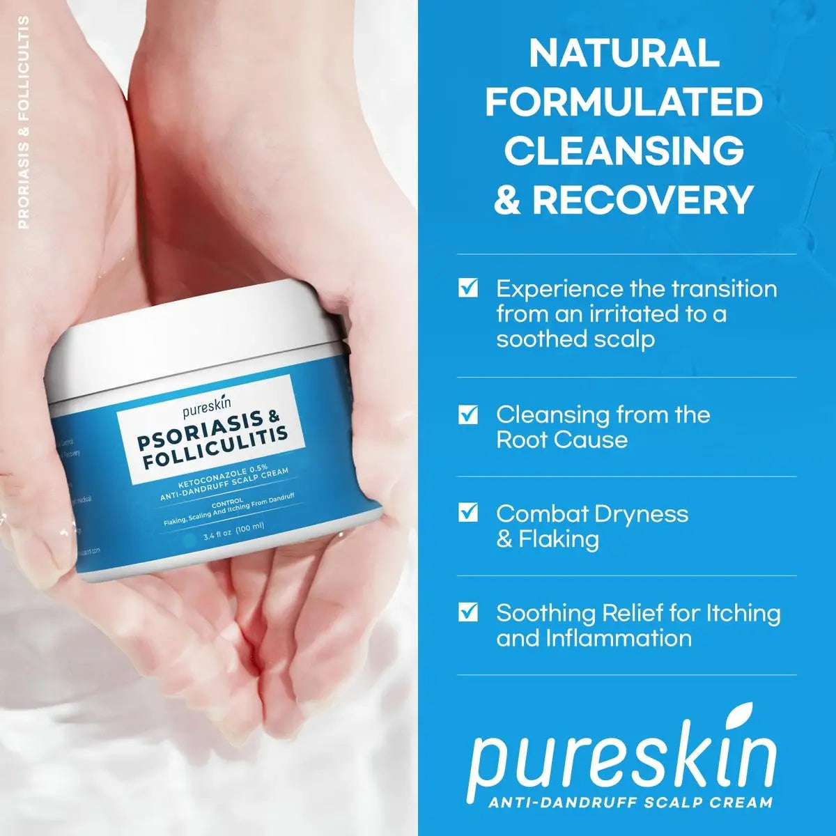 PURESKIN Scalp Cream for Psoriasis & Folliculitis – Herbal Relief for Itching & Flaking, 3.4 Oz Avelisse