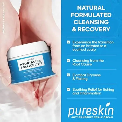 PURESKIN Scalp Cream for Psoriasis & Folliculitis – Herbal Relief for Itching & Flaking, 3.4 Oz Avelisse