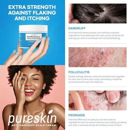 PURESKIN Scalp Cream for Psoriasis & Folliculitis – Herbal Relief for Itching & Flaking, 3.4 Oz Avelisse