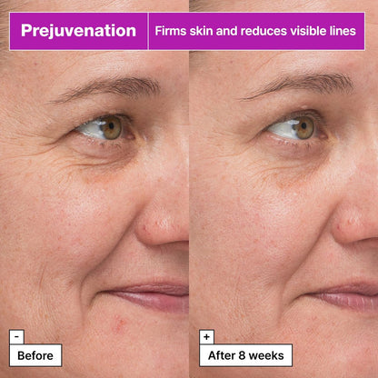 Dr.Jart+ Prejuvenation Firming Bakuchiol Serum with Collagen Peptides | Korean Anti-Aging Serum | Sensitive Skin Friendly | 1.69 Fl Oz Avelisse