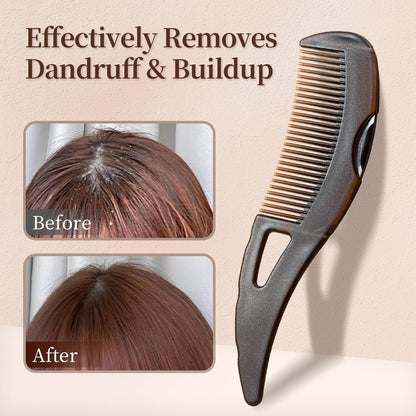 2-Pack Dandruff Comb: Scalp Sweep Detoxing Energy Comb for Scalp Cleaning, Exfoliation, Massage & Oil Buildup Removal – Plastic Hollow Tooth Hairbrush for Women, Men & Kids (Brown, Medium)