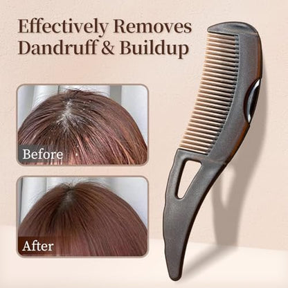 2-Pack Dandruff Comb: Scalp Sweep Detoxing Energy Comb for Scalp Cleaning, Exfoliation, Massage & Oil Buildup Removal – Plastic Hollow Tooth Hairbrush for Women, Men & Kids (Brown, Medium)