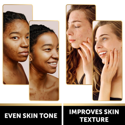 VALITIC Kojic Acid Soap Bars - Turmeric, Snail Mucin, Charcoal & Lemon - 4 Assorted Dark Spot Remover Soaps with Hyaluronic Acid, Vitamin C, Vitamin E & Shea Butter