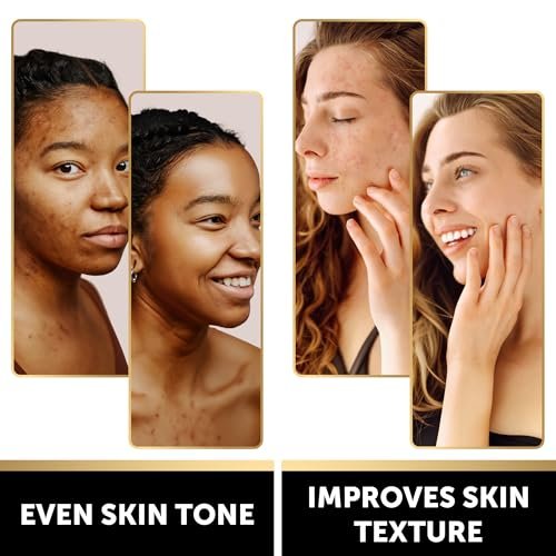 VALITIC Kojic Acid Soap Bars - Turmeric, Snail Mucin, Charcoal & Lemon - 4 Assorted Dark Spot Remover Soaps with Hyaluronic Acid, Vitamin C, Vitamin E & Shea Butter - görsel 4