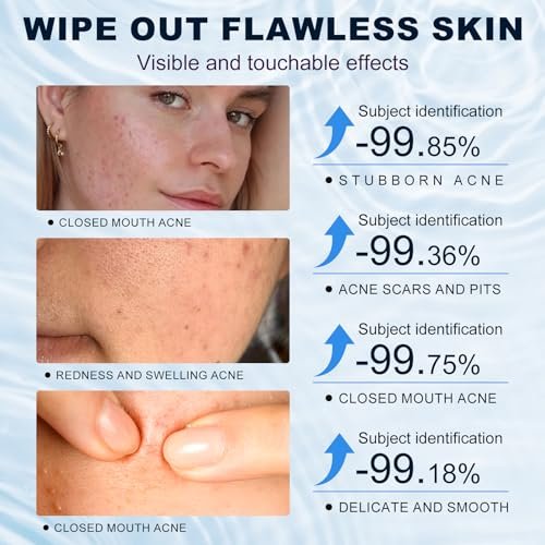 Azelaic Acid 10% Cream for Face – Acne & Rosacea Relief, Reduces Pimples, Blackheads, Pigmentation & Redness - görsel 12