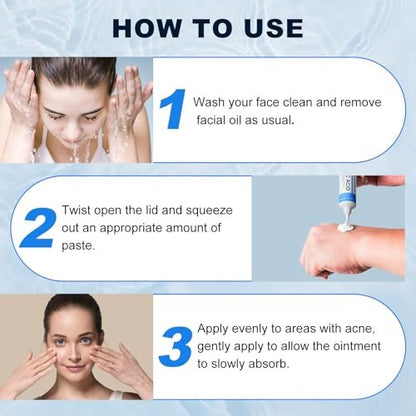 Azelaic Acid 10% Cream for Face – Acne & Rosacea Relief, Reduces Pimples, Blackheads, Pigmentation & Redness