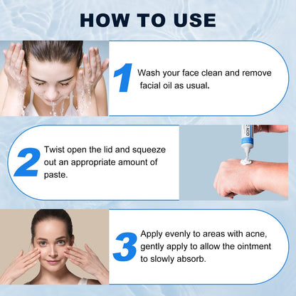 Azelaic Acid 10% Cream for Face – Acne & Rosacea Relief, Reduces Pimples, Blackheads, Pigmentation & Redness