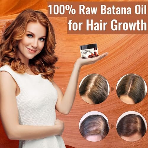 100% Unrefined Raw Batana Oil for Hair Growth - Dr. Sebi Inspired Organic Pure from Honduras with Keratin & Coffee Extract - Botana Oil 4oz Avelisse
