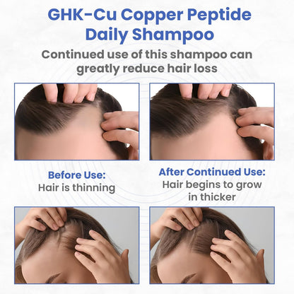Copper Peptide Shampoo – Anti Hair Loss Shampoo for Hair Regrowth | PeptideLabz Avelisse