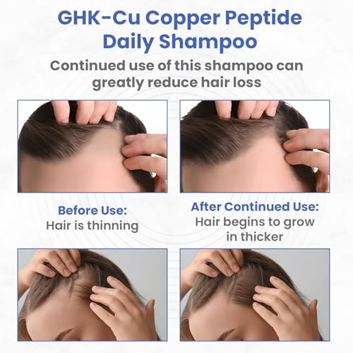 Copper Peptide Shampoo – Anti Hair Loss Shampoo for Hair Regrowth | PeptideLabz Avelisse
