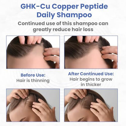 Copper Peptide Shampoo – Anti Hair Loss Shampoo for Hair Regrowth | PeptideLabz Avelisse