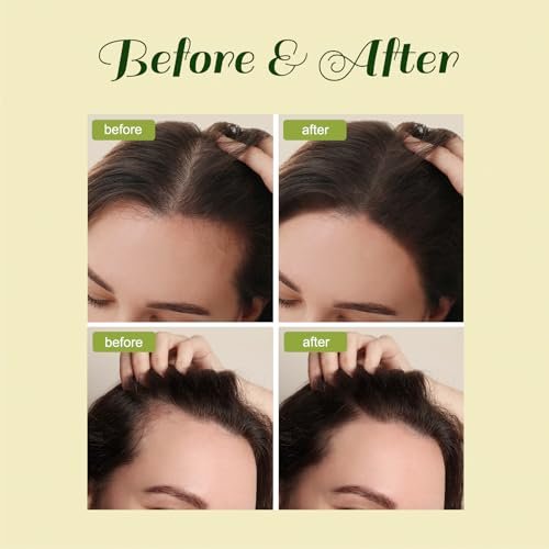 Natural Hair Growth Oil for Men and Women - Batana & Rosemary Infused (2 fl oz) by BabyFaceDiary Avelisse