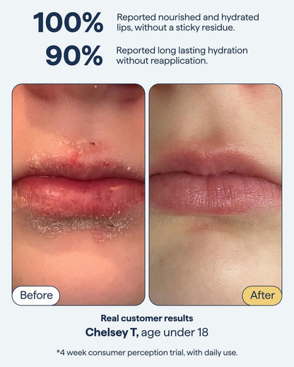 All-In-One Lip Treatment for Dry Lips | Hydrating Lip Balm Ointment with Ceramides, Peptides, and Dimethicone | Repairs Dry, Cracked Lips | By Dermatologist Dr. Shah | Remedy Science