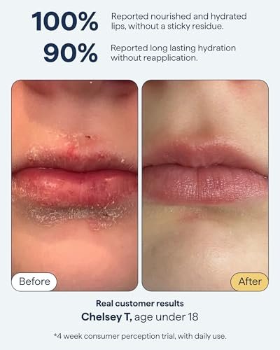 All-In-One Lip Treatment for Dry Lips | Hydrating Lip Balm Ointment with Ceramides, Peptides, and Dimethicone | Repairs Dry, Cracked Lips | By Dermatologist Dr. Shah | Remedy Science