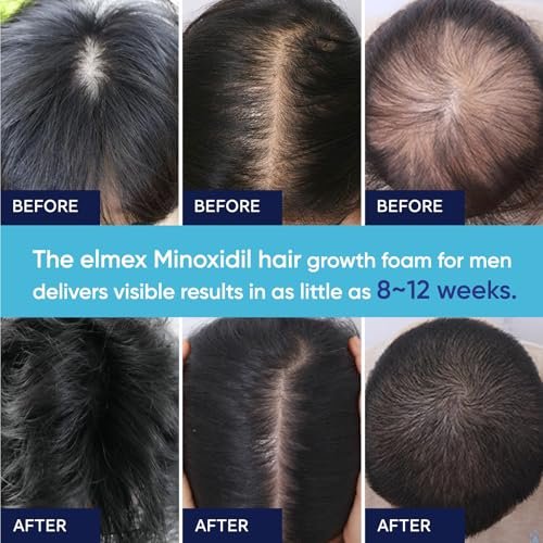 5% Minoxidil Foam for Men and Women – Hair Regrowth Treatment (60ml) - görsel 9