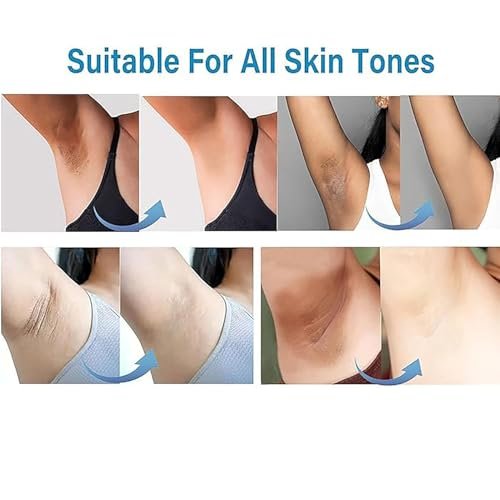 Ceavo Skin Whitening Cream for Intimate Areas, Underarms, Knees, Elbows & Inner Thighs - Dark Spot Remover, 1.7 Fl Oz Avelisse