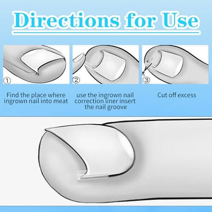 Ingrown Toenail Treatment Corrector Set (50+1 Pcs) – Professional Pain-Free Removal Kit with Lifter & Strips for Men & Women Avelisse