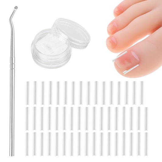 Ingrown Toenail Treatment Corrector Set (50+1 Pcs) – Professional Pain-Free Removal Kit with Lifter & Strips for Men & Women Avelisse
