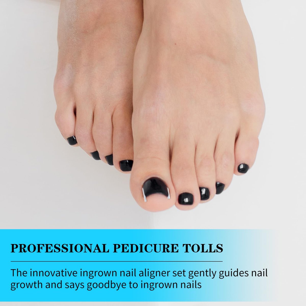 Ingrown Toenail Treatment Corrector Set (50+1 Pcs) – Professional Pain-Free Removal Kit with Lifter & Strips for Men & Women Avelisse