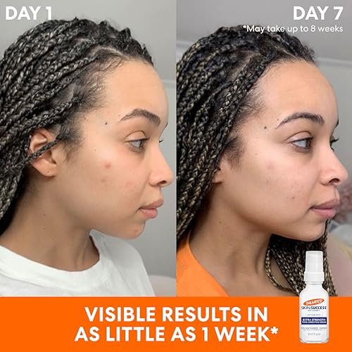 Palmer's Skin Success Extra Strength Tone Correcting Face Serum for Dark Spots, 1.0 Fl Oz Avelisse
