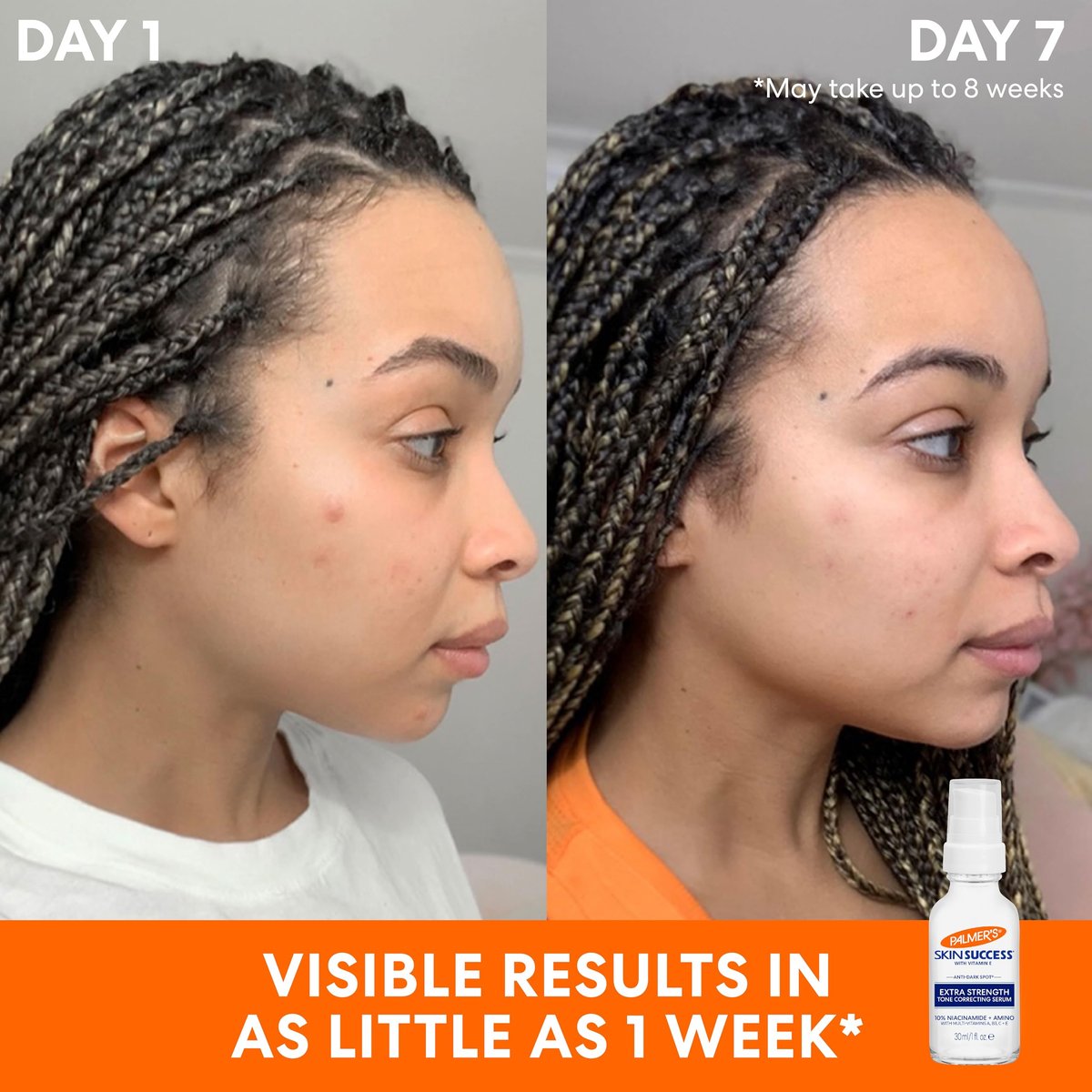 Palmer's Skin Success Extra Strength Tone Correcting Face Serum for Dark Spots, 1.0 Fl Oz Avelisse