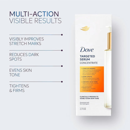 Dove Targeted Serum Multipurpose for Stretch Marks, Dark Spots, Uneven Skin Tone and Elasticity - 3.2 oz Avelisse
