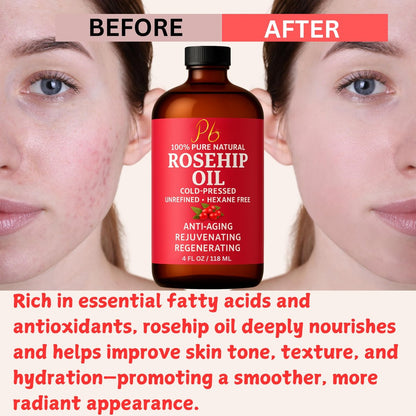 Pomberries Rosehip Seed Oil – Cold-Pressed & Unrefined, Natural Face Oil for Scars, Wrinkles, Stretch Marks & Daily Hydration, 4 fl oz