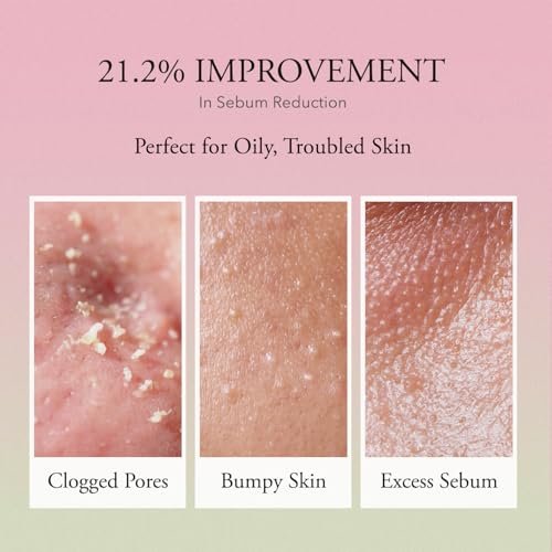APRILSKIN Pink Aloe Vita Toner – Calming & Hydrating Korean Toner with 80% Pink Aloe Vera, Soothes Redness, Controls Sebum, Vegan & Clean (8.45 fl.oz) Avelisse
