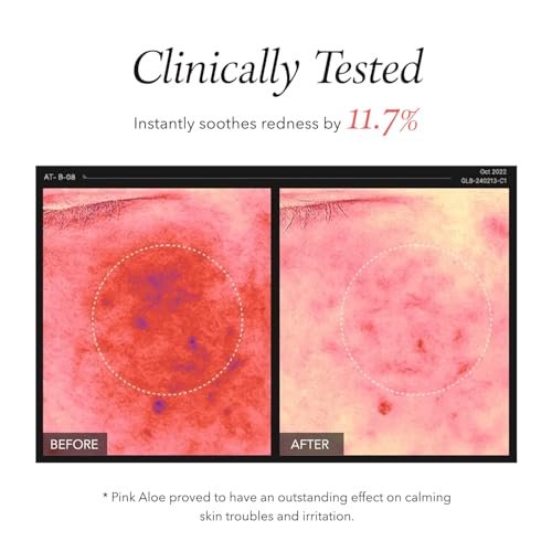 APRILSKIN Pink Aloe Facial Polish Cleanser | Gentle Exfoliation with Mungbean & Soybean Scrub | Removes Waterproof Makeup & Sunscreen | Non-Comedogenic Korean Skincare - görsel 7