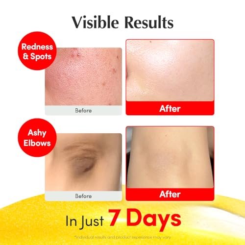 EQQUALBERRY Vitamin Illuminating Serum | Niacinamide 4% + Brightening Vitamin C Face Serum with Hyaluronic Acid & Vitamin E | Dark Spot & Uneven Tone Corrector | Korean Skincare, 1.01 fl.oz Avelisse