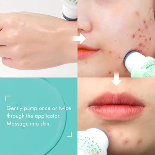 NATUREKIND Heartleaf Tea Tree Tok Acne Treatment Soothing Toner Serum – Korean Facial Skincare for Pore Control, Calming & Nourishing (1.69 fl oz) - görsel 10
