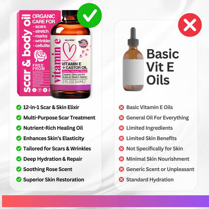 Organic Vitamin E Oil for Scars, Stretch Marks, Wrinkles & Cellulite – Scar Away Treatment with Castor, Rosehip, Jojoba, Almond – Hydrating & Moisturizing Face & Body Oil, 2 Fl Oz Avelisse