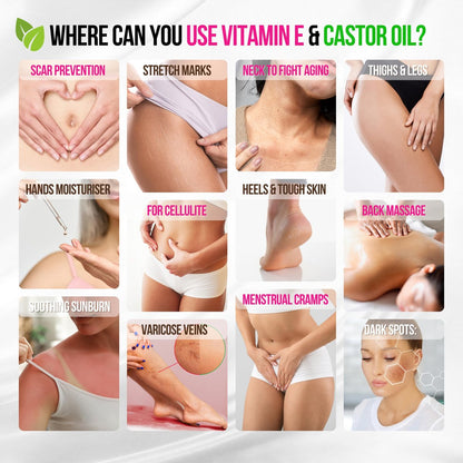 Organic Vitamin E Oil for Scars, Stretch Marks, Wrinkles & Cellulite – Scar Away Treatment with Castor, Rosehip, Jojoba, Almond – Hydrating & Moisturizing Face & Body Oil, 2 Fl Oz Avelisse