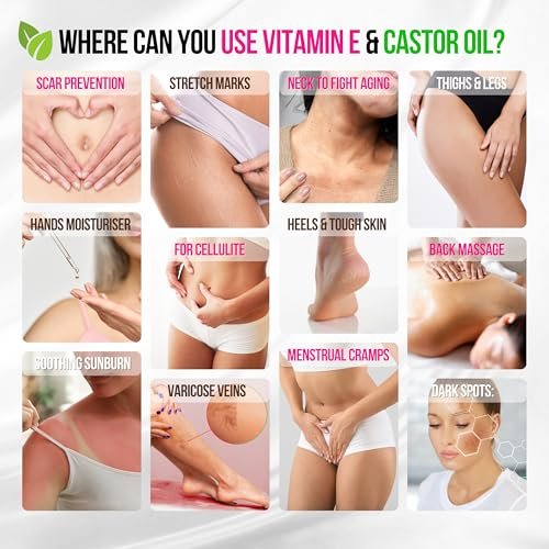 Organic Vitamin E Oil for Scars, Stretch Marks, Wrinkles & Cellulite – Scar Away Treatment with Castor, Rosehip, Jojoba, Almond – Hydrating & Moisturizing Face & Body Oil, 2 Fl Oz Avelisse