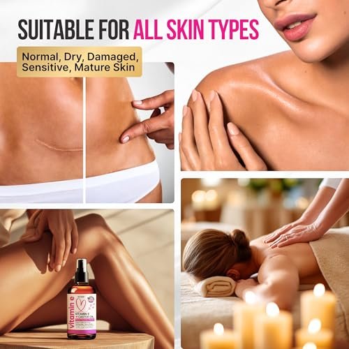 Organic Vitamin E Oil for Scars, Stretch Marks, Wrinkles & Cellulite – Scar Away Treatment with Castor, Rosehip, Jojoba, Almond – Hydrating & Moisturizing Face & Body Oil, 2 Fl Oz Avelisse