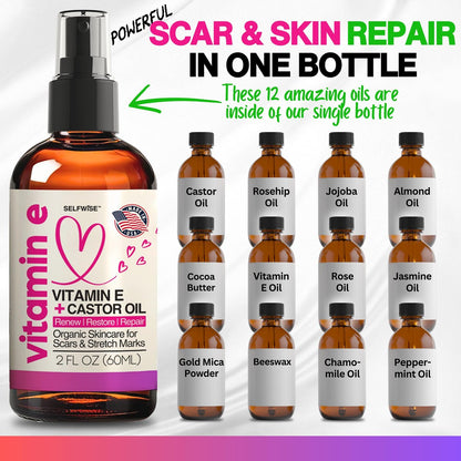 Organic Vitamin E Oil for Scars, Stretch Marks, Wrinkles & Cellulite – Scar Away Treatment with Castor, Rosehip, Jojoba, Almond – Hydrating & Moisturizing Face & Body Oil, 2 Fl Oz Avelisse