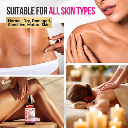Organic Vitamin E Oil for Scars, Stretch Marks, Wrinkles & Cellulite – Scar Away Treatment with Castor, Rosehip, Jojoba, Almond – Hydrating & Moisturizing Face & Body Oil, 2 Fl Oz Avelisse