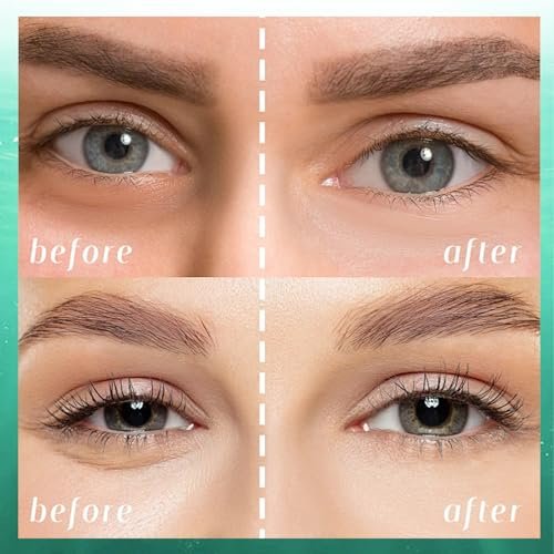 firstfly Under Eye Patches - 60 PCS Aloe Vera Eye Masks for Dark Circles and Puffiness, Hydrating Eye Mask Skincare Avelisse