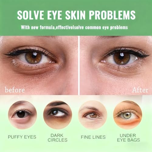 firstfly Under Eye Patches - 60 PCS Aloe Vera Eye Masks for Dark Circles and Puffiness, Hydrating Eye Mask Skincare Avelisse