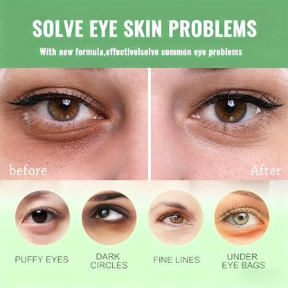 firstfly Under Eye Patches - 60 PCS Aloe Vera Eye Masks for Dark Circles and Puffiness, Hydrating Eye Mask Skincare Avelisse