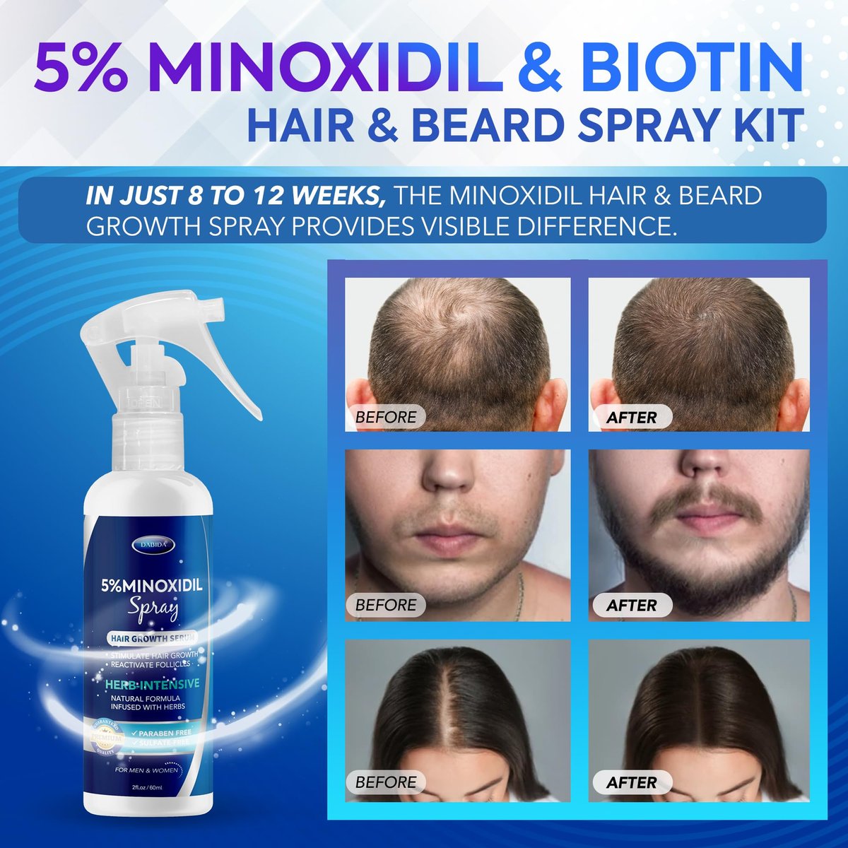 DABIDA 5% Minoxidil Hair Regrowth Spray for Women & Men Beard Growth - 60ml - görsel 3