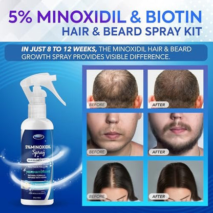 DABIDA 5% Minoxidil Hair Regrowth Spray for Women & Men Beard Growth - 60ml
