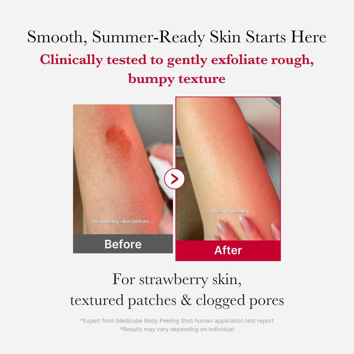 medicube Red Body Peeling Shot - AHA + BHA Exfoliating Body Spray for Smooth Skin, Treats Strawberry Skin & Bumps, 3.88 oz Avelisse