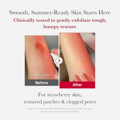 medicube Red Body Peeling Shot - AHA + BHA Exfoliating Body Spray for Smooth Skin, Treats Strawberry Skin & Bumps, 3.88 oz Avelisse