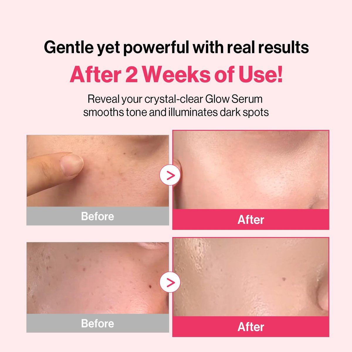 Redence Dark Spot Corrector Serum with 5% Niacinamide & Vitamin C | Tone & Spot Ampoule for Uneven Tone & Hydration | Korean Daily Skincare for All Skin Types | 30ml / 1 fl oz Avelisse