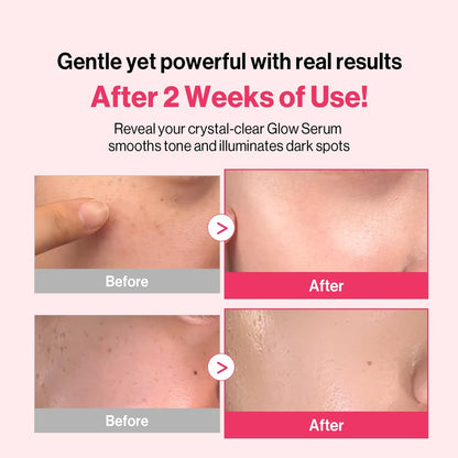 Redence Dark Spot Corrector Serum with 5% Niacinamide & Vitamin C | Tone & Spot Ampoule for Uneven Tone & Hydration | Korean Daily Skincare for All Skin Types | 30ml / 1 fl oz Avelisse