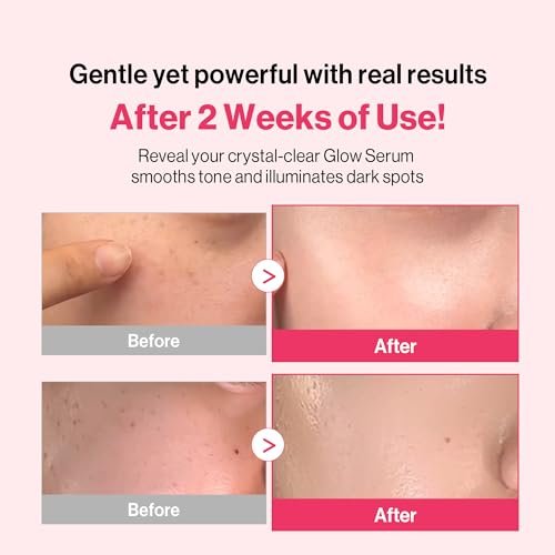 Redence Dark Spot Corrector Serum with 5% Niacinamide & Vitamin C | Tone & Spot Ampoule for Uneven Tone & Hydration | Korean Daily Skincare for All Skin Types | 30ml / 1 fl oz Avelisse