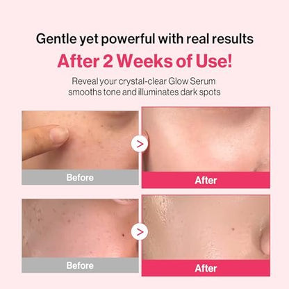 Redence Dark Spot Corrector Serum with 5% Niacinamide & Vitamin C | Tone & Spot Ampoule for Uneven Tone & Hydration | Korean Daily Skincare for All Skin Types | 30ml / 1 fl oz Avelisse