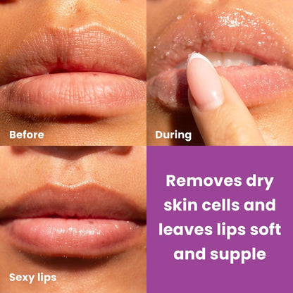 Dermasuri Lip Exfoliator Scrub & Moisturizer – Sugar Scrub for Dark Lips, Overnight Hydration, Coconut Passion Fruit – 0.7 oz